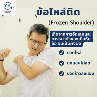 ข้อไหล่ติด (Frozen Shoulder)